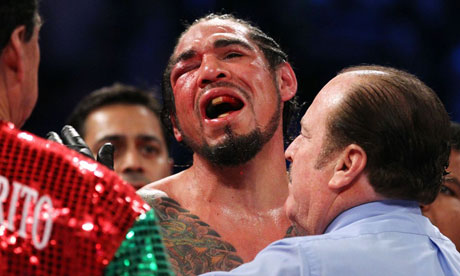 Antonio-Margarito-loses-t-007 Antonio-Margarito-loses